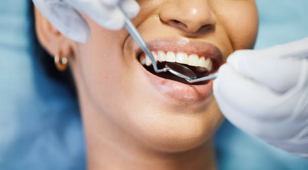 Best Lost Filling or Crown Replacement in Boutte, LA